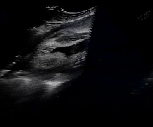 Agak2 Jantina apa ya?