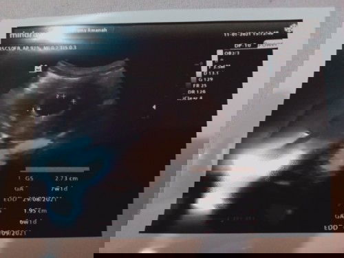 Brgkali bisa tukar info bunda..kbtln sy kmrn usg yg prtm kali usia kehamilan 6 mggu lbh.