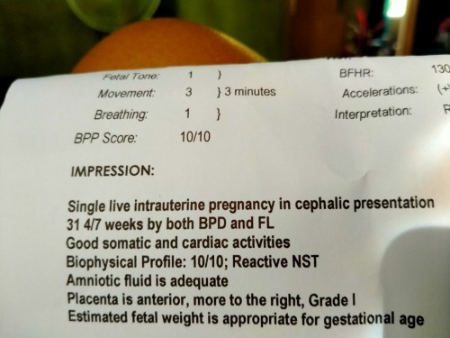 Ok lang po ba yung result mga mommy?