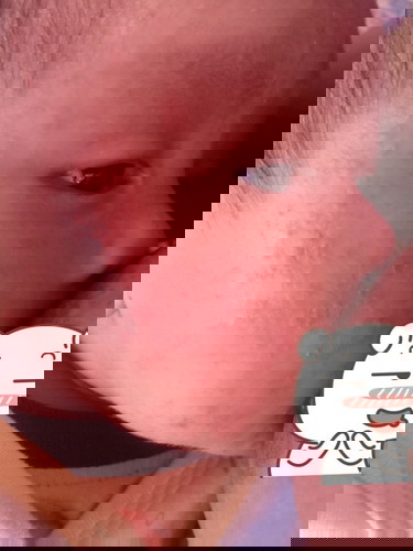 แพ้อ่ะไรค่ะแบบนี้