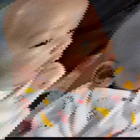 ลูกน้อยบ้านไหนผดผื่นขึ้นเยอะบ้างค่ะ พอจะมีวิธีรักษาแนะนำไหมค่ะ