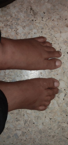 Sye x tahu sakit kaki nie