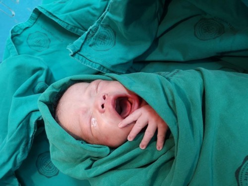 ผ่าคลอด 12.01.2021