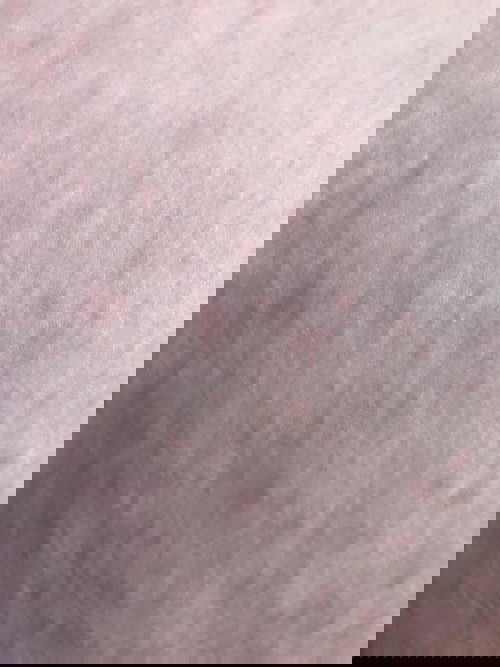 Ruam kemerahan dikulit saat hamil 32 minggu