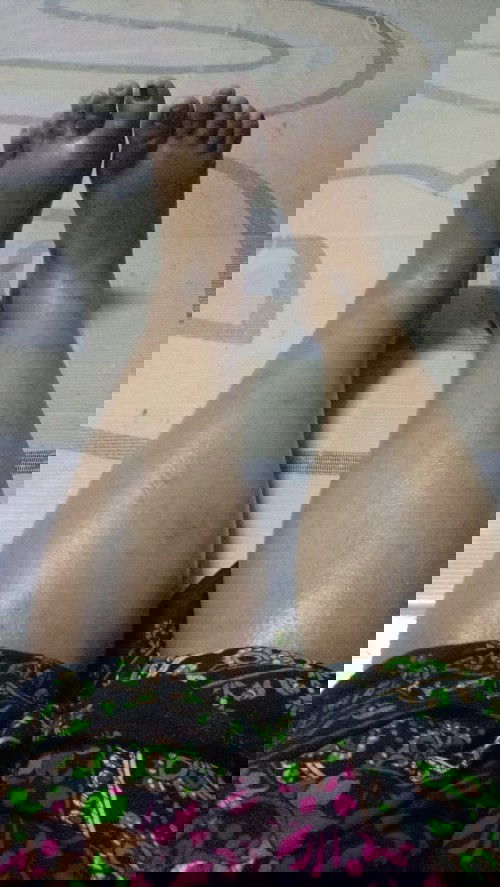 Masalah kaki dan betis bengkak