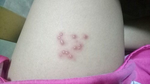 Ano to? Kumpol at makirot