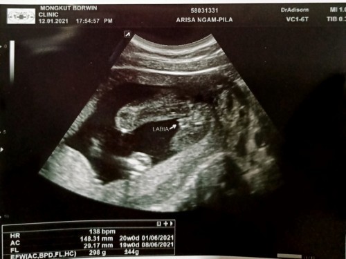 แบบนี้ลูกสาวไหมค่ะ