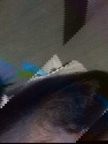 Pag lagas ng buhok