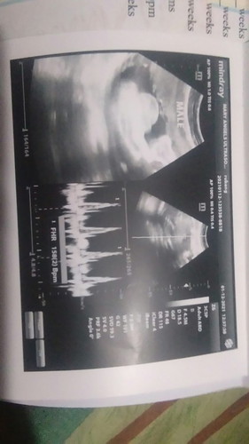 Ano po mga madalas pinapadala sa hospital ? 34 weeks .. NearLy uala pa po kasi ako list na binigay..