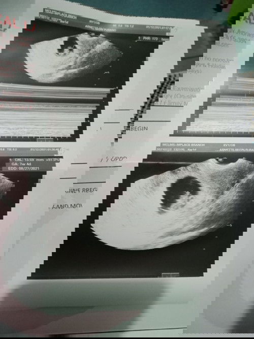 Anxious about TVs Result