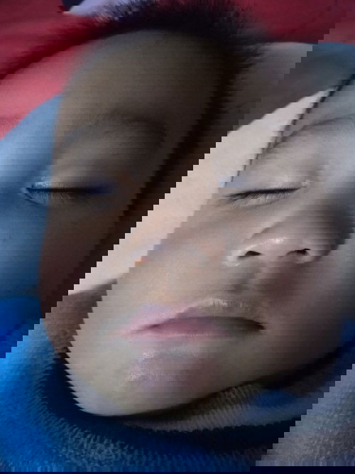 ยาทาแก้มเด็ก