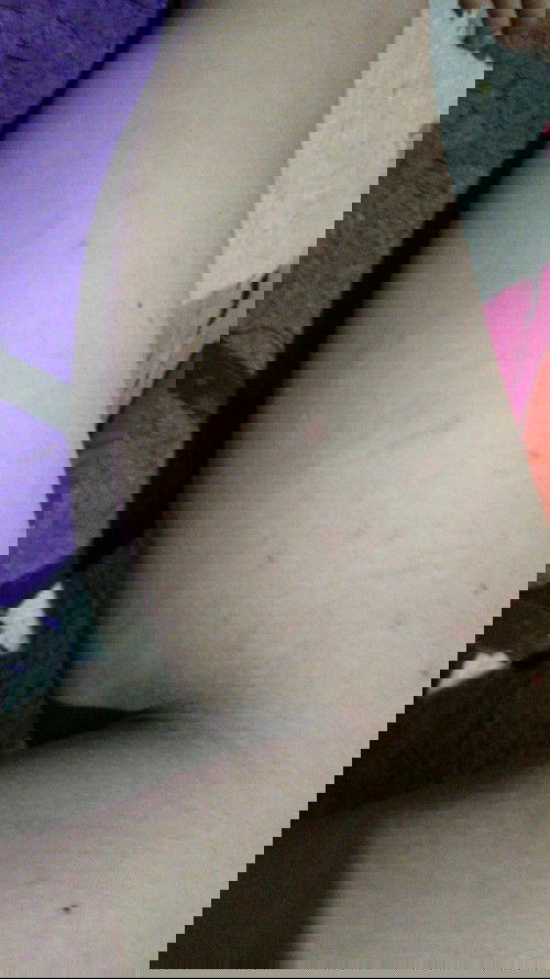 Bunda2 ada yg ngalamin gatel ga SII di week 30.
Obatnya apa yaa