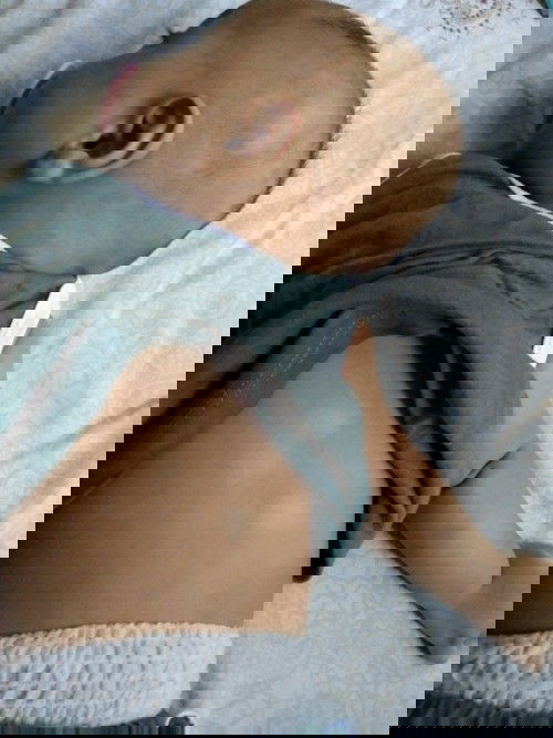 Kesehatan kulit bayi