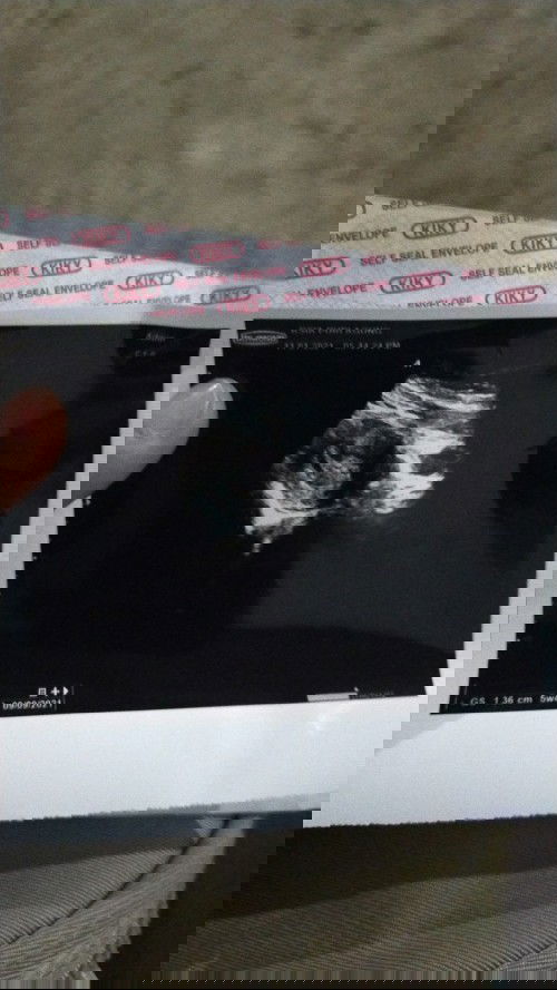 enduthchen@gmail.com