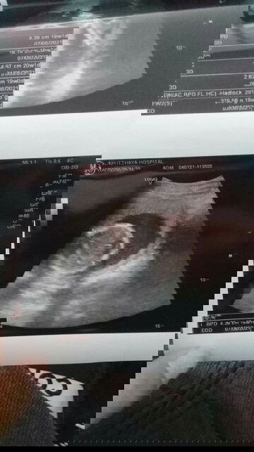 ไปซาวเมื่อวานน้ำหนักลูก279.58g 19w4dในเเอปนี้บอกลูกต้องน้ำหนัก240.0gเเบบนี้ลูกจะตัวเล็กไหมคะกังวลมาก