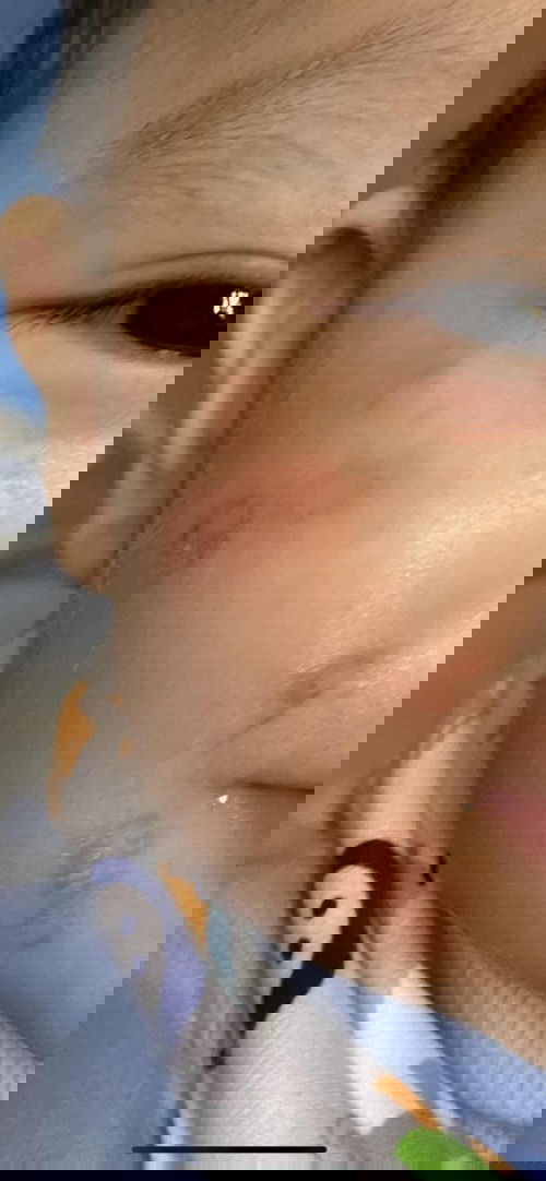 Da bé bị gì đây ạ