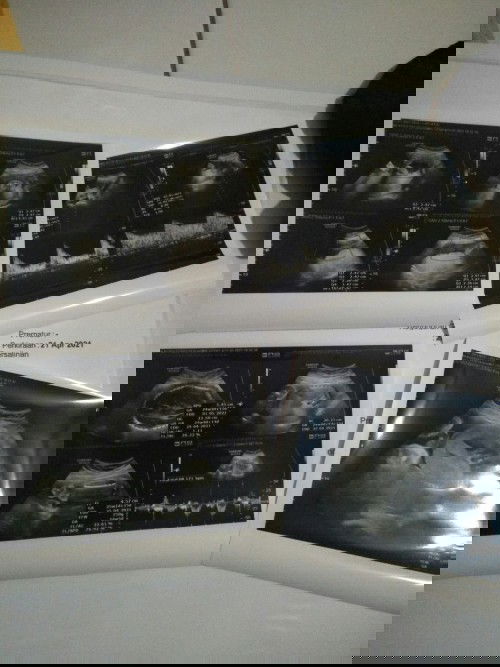 Naikin berat badan bayi