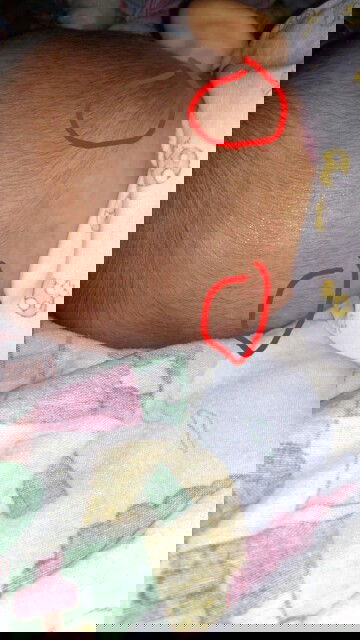 kepala bayi bagian belakang bawah ada benjolan