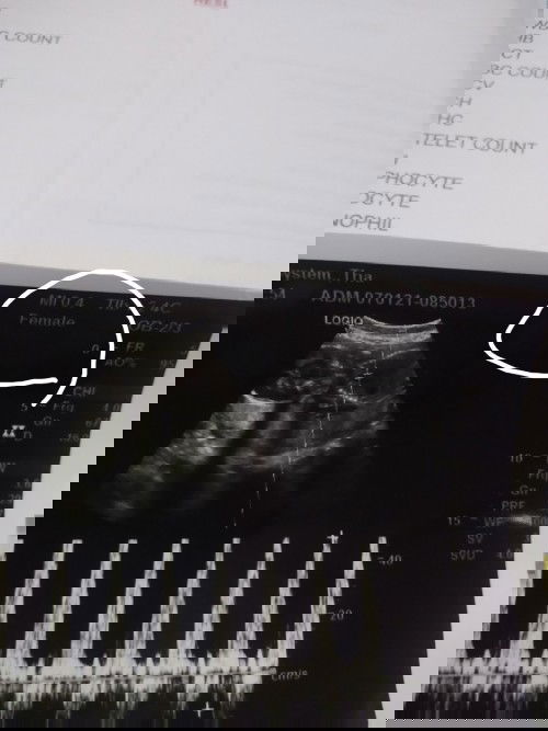 แบบนี้ในใบซาวหมายถึงอะไีรค่ะ