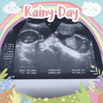 19 w 6 d