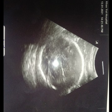 💚คุนแม่มือใหม่💚