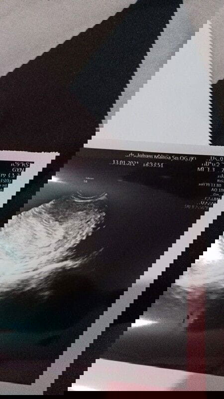 pendapat nya dong bun