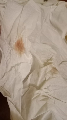 Bahaya gk bund, saya hamil 12 minggu trus tiba² keluar cairan coklat tapi gk ada sakit perut