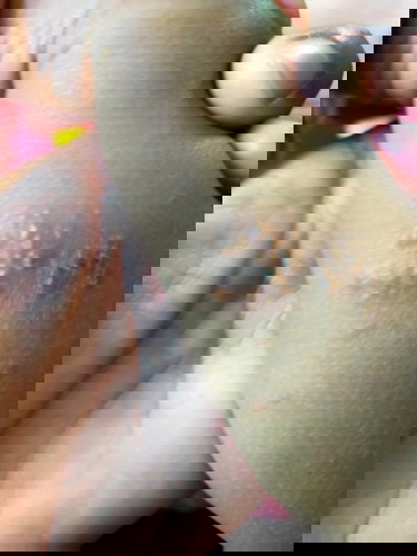 ผื่นคันตาทตัวลูกน้อย.