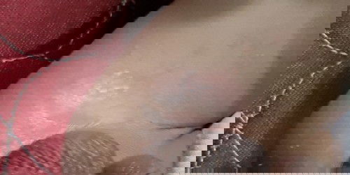 MERAH MERAH DI AREA TITIT BAYI