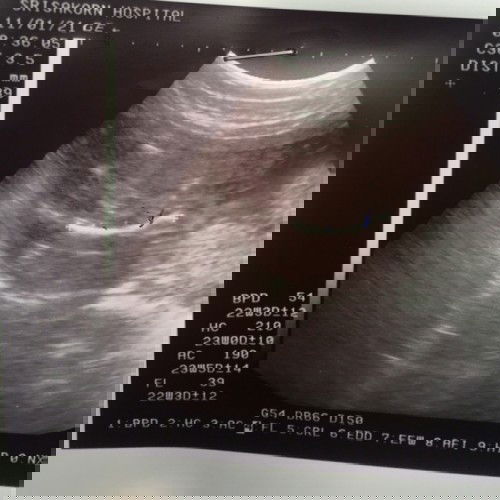 อยากรู้ผลอัตตราซาว