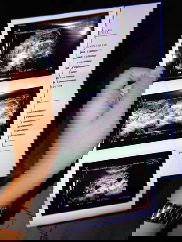 น้ำคล่ำน้อยมีใครพอมีประสบเหตุเเบบนี้บ้างค่ะ