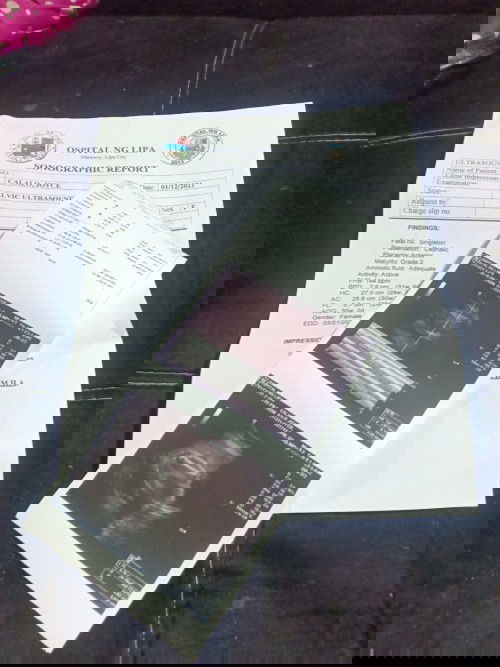 Ano pong pwede ipangalan sa nagsisimula sa J at C Baby Girl po.