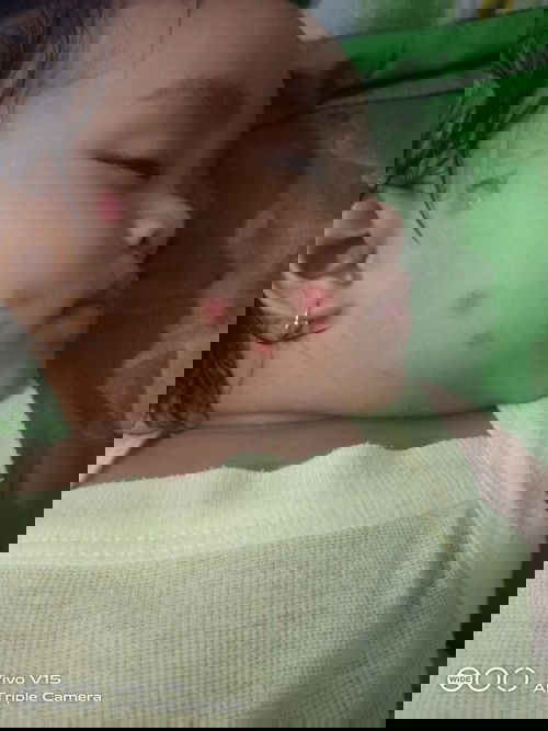 Anak 11 bulan sering sakit