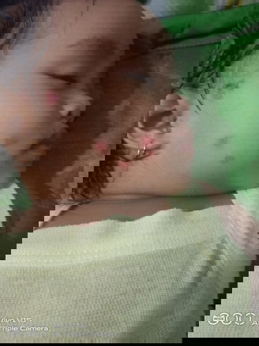 Anak 11 bulan sering sakit