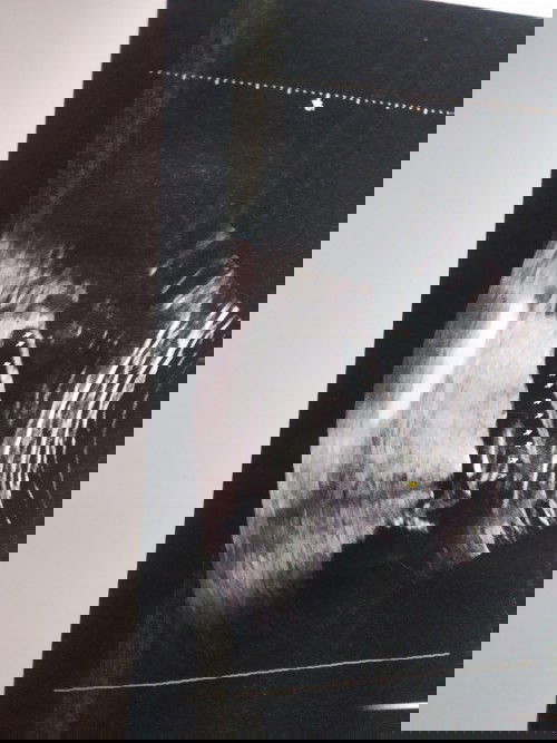 Ada Dinding Pemisah di rahim