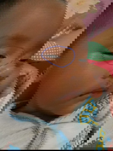 kulit bayi