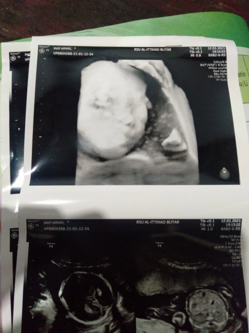 Cowok apa cewek?