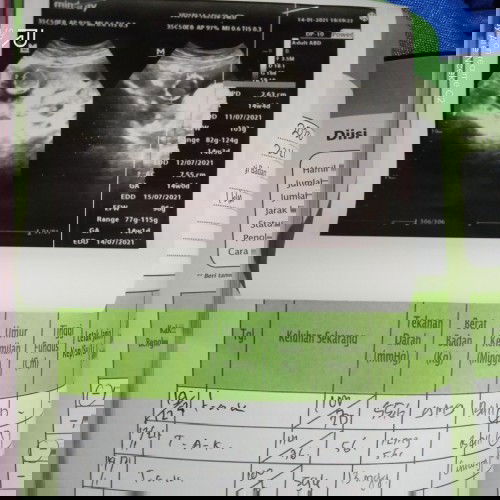 Placenta dibawah dan air ketuban kurang 13weeks