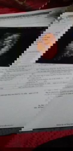 Nhờ xin vía các mom nay mình đi s.âm ra bé trai nè