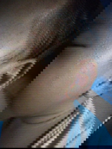 Skin Problem