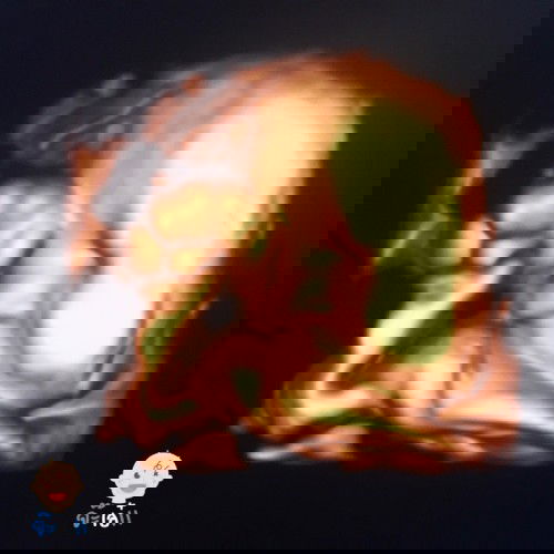 34 Week 6 Day 👶🏻👶🏻