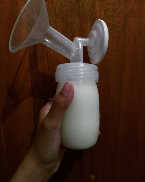 Hiperlaktasi hingga mastitis 2x dan abses payudara