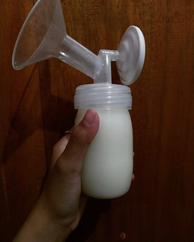 Hiperlaktasi hingga mastitis 2x dan abses payudara