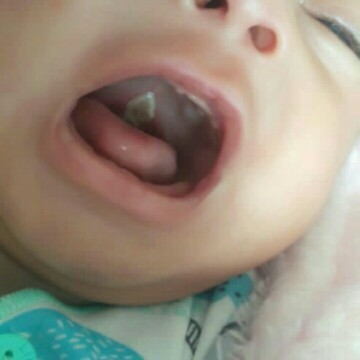 Pengen ade sembuh