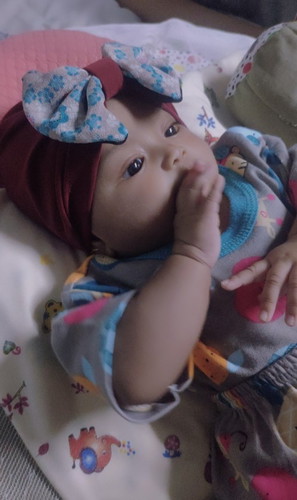 Kepala bagian belakang hangat