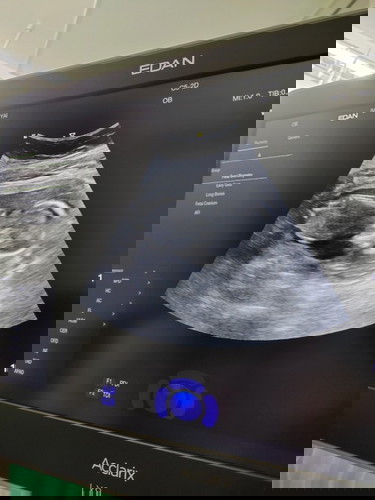 อยากขอกำลังใจจากแม่ๆ ค่ะ