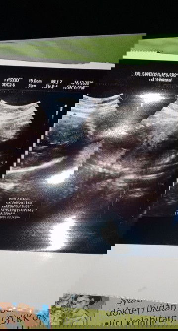 Mau nanya hasil usg