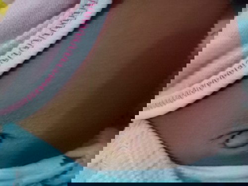 Ini gatal gatal kah?