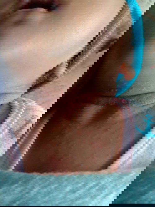 Bunda" bagi pengalamannya donk kalo merah" kaya d foto obat nya apa atau solusinya gmn