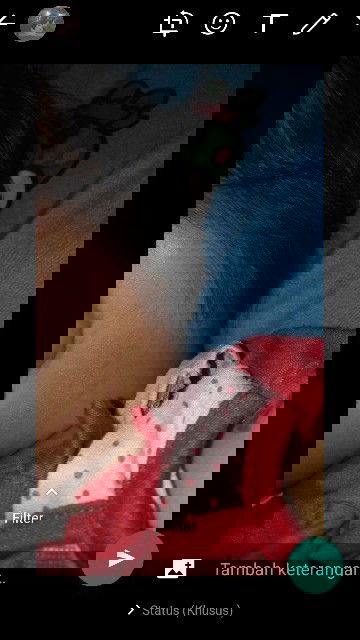 Kulit anak kering dan merah